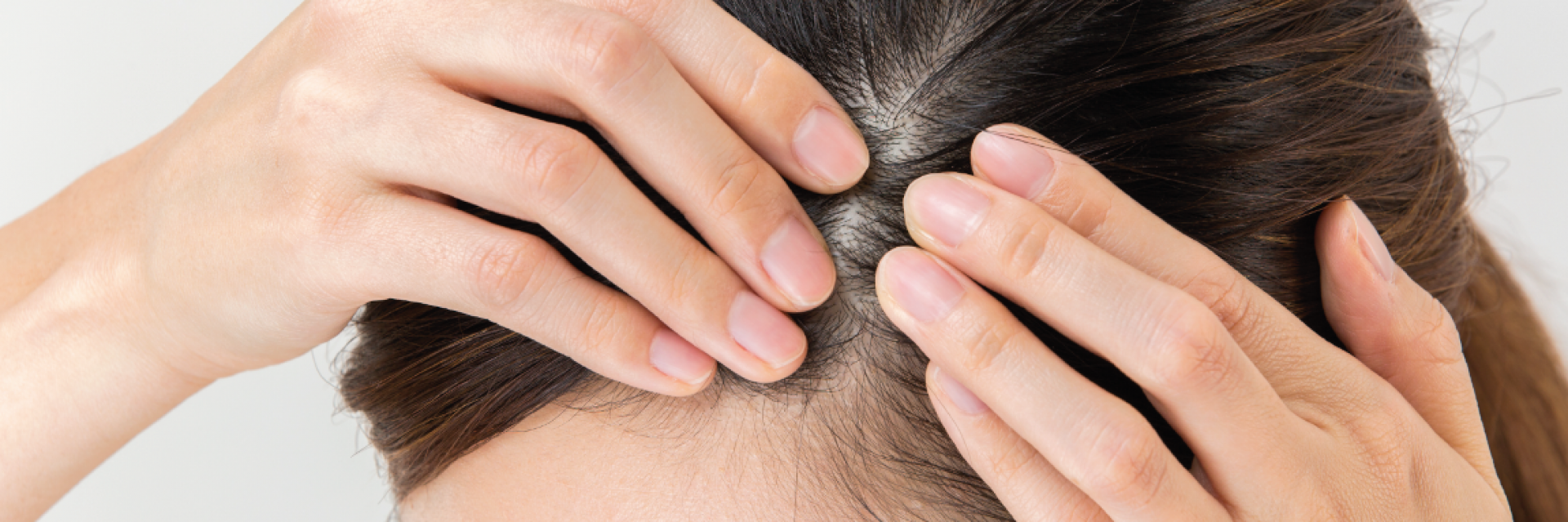 L’estudi SCALP-PR demostra l’eficàcia d’Emolienta Scalp i el situa com a tractament de referència per a la picor del cuir cabellut